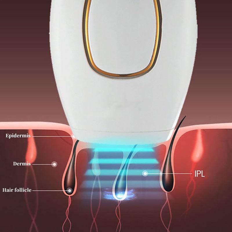 Depilador a Laser Definitivo Importado/LaserDepil - Amerloja